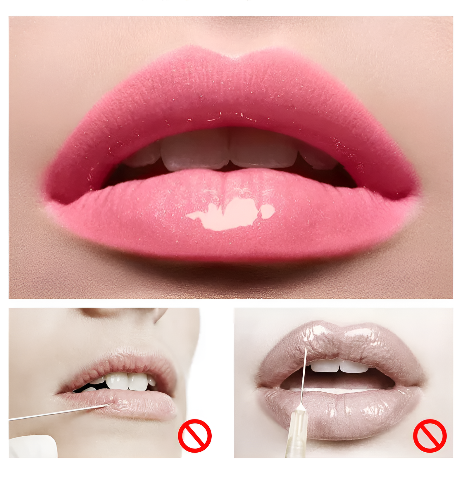 SoftVolume™ Lip Maximizer